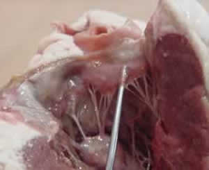 Biology -Circulatory system -Heart dissection (part 1)