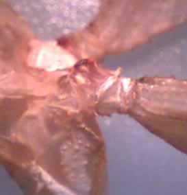 The flexible joint of the leg.