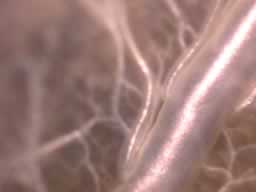 The fine network of tracheoles.