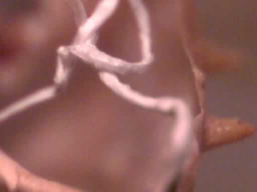 The fine tubes(tracheoles) that take oxygen to the body are visible in the skin that is shed.